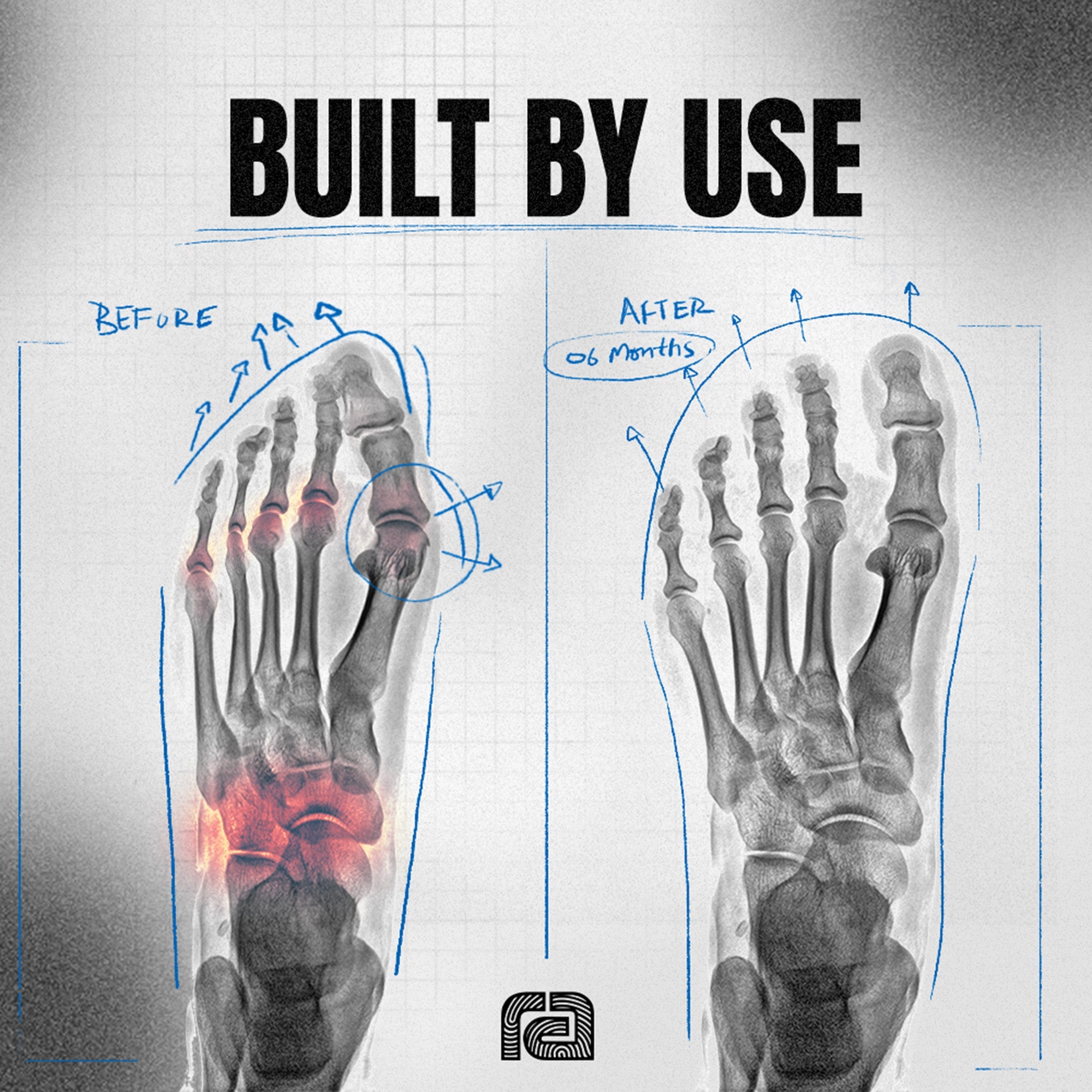 Why Running Barefoot Might Be the Healthiest Thing You Can Do for Your Feet