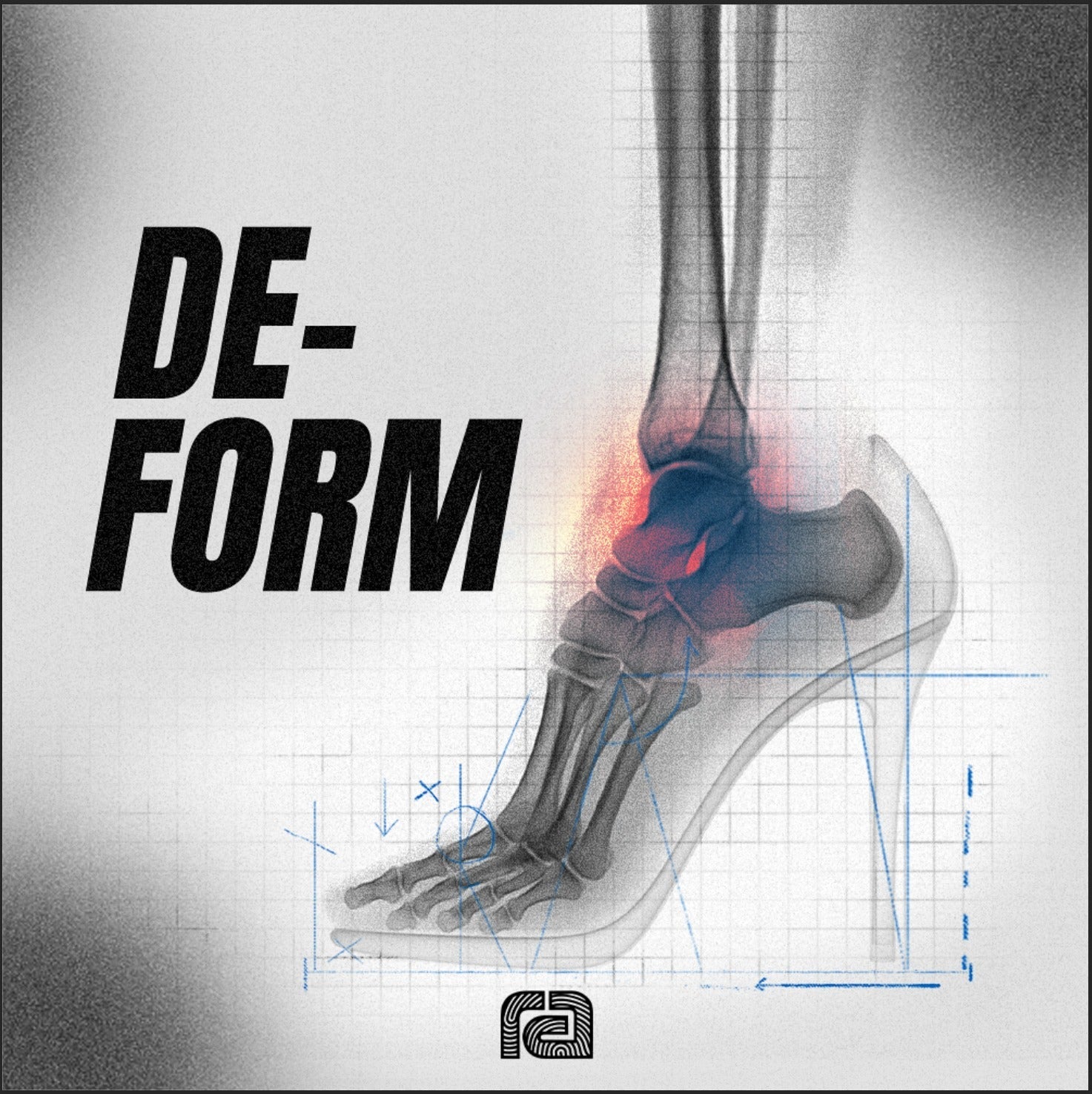 How Footwear Changes Your Feet, Even When You Don’t Feel It